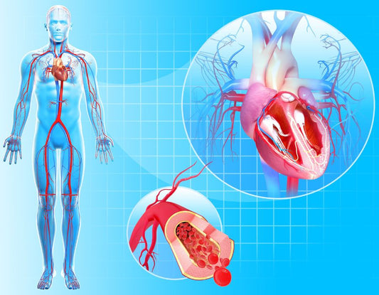 Root Causes of Cardiovascular Disease