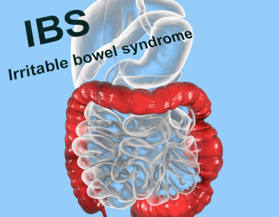 5 Causes of Irritable Bowel Syndrome