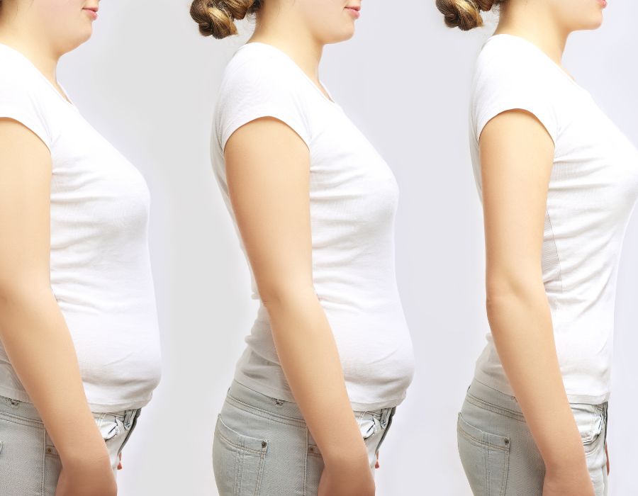Aggressive Prescription Weight Loss