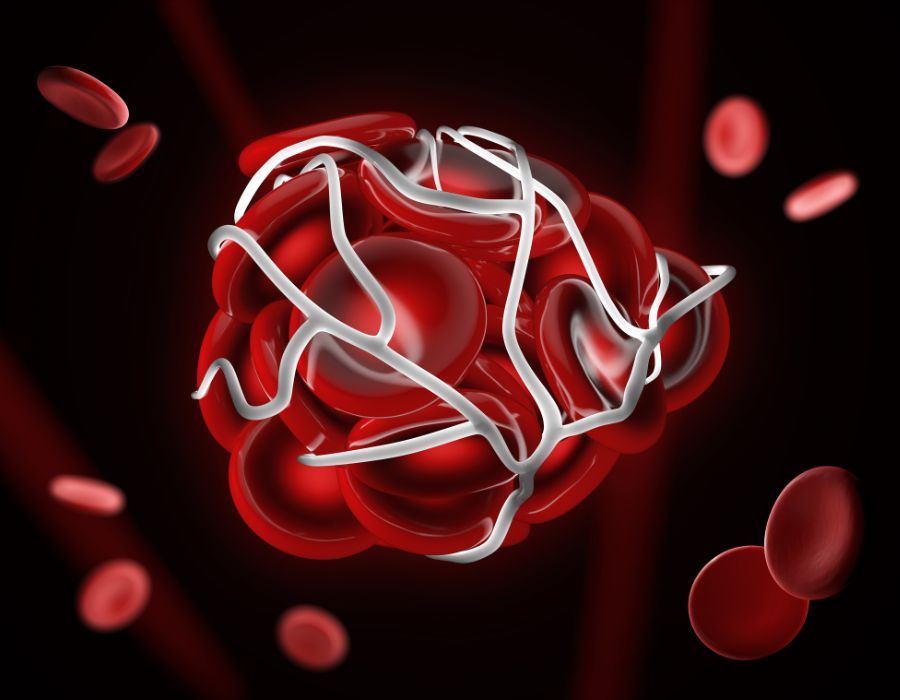 Is Your Blood Too Thick?
