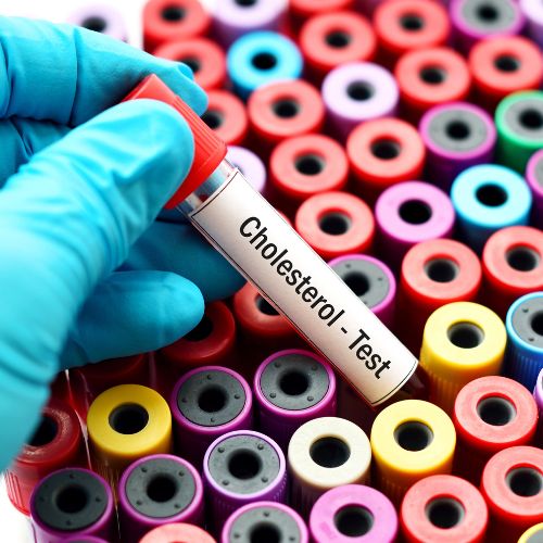 More Than Cholesterol
