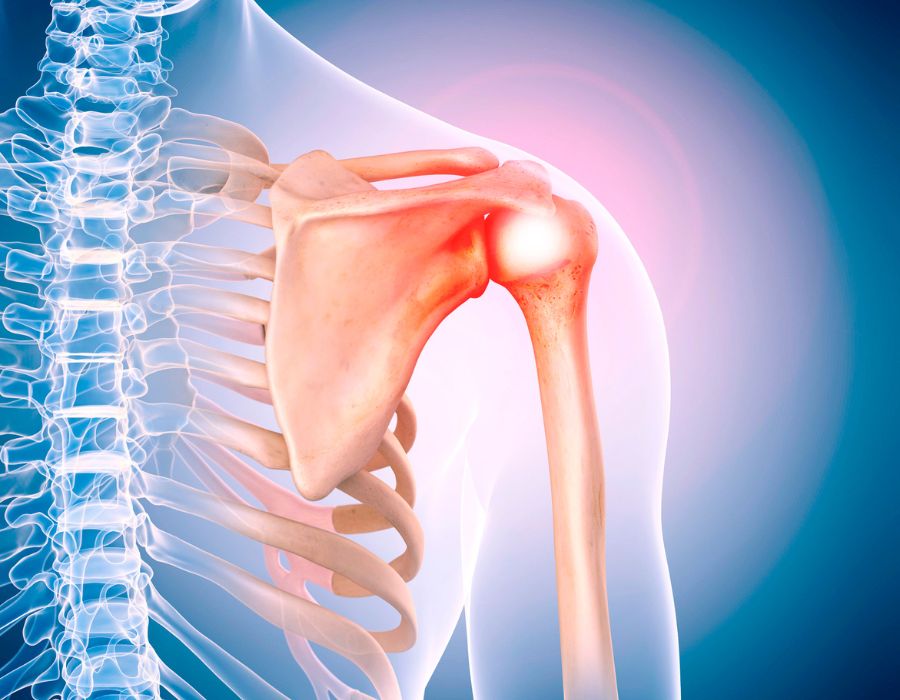 Is Physical Therapy the Better Alternative for Shoulder Pain?