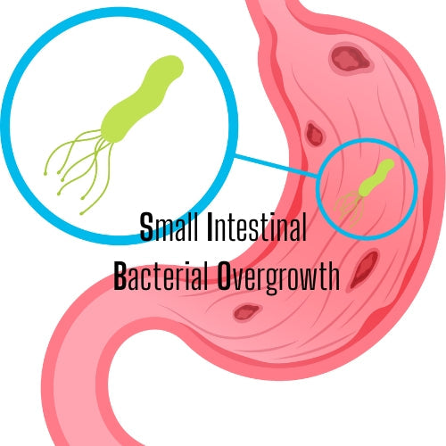 The Holistic Treatment of SIBO