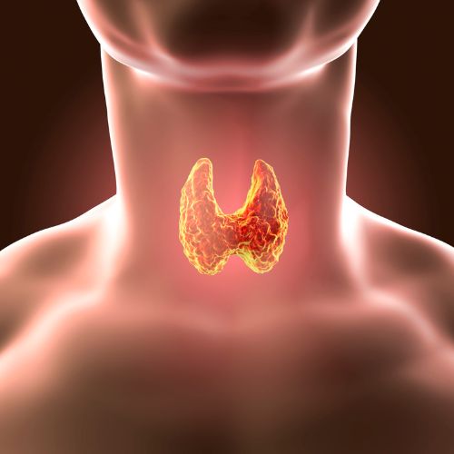 The Silent Thyroid Epidemic