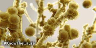 Episode 104_Common Fungal issues people are experiencing_Americas Natural Doctor