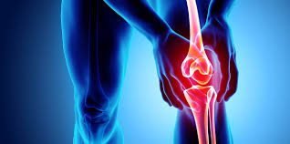 Episode 111_ Joint Related Issues America's Natural Doctor
