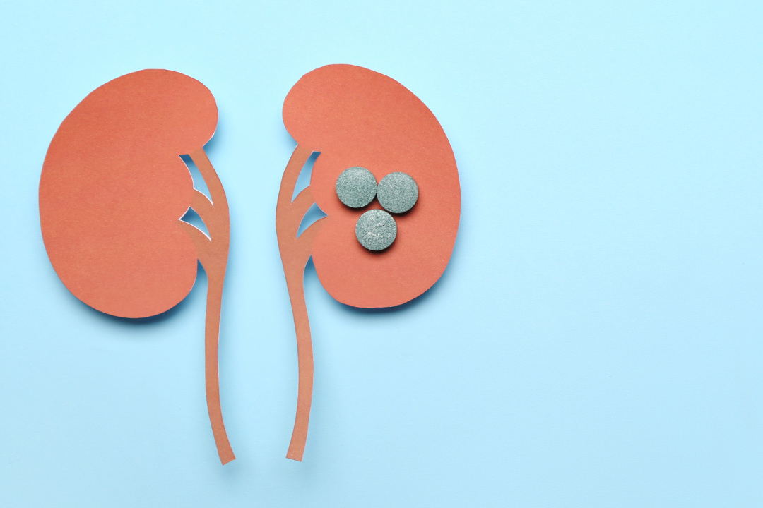 Kidney Stone Prevention With Potassium