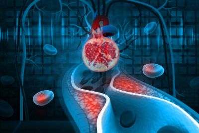 Can Pomegranate Juice Help Blood Pressure and Artery Health?