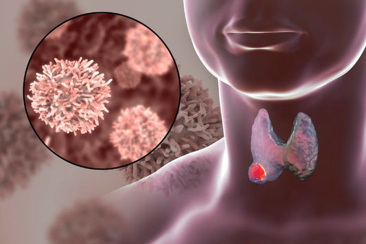 How Environmental Toxins Can Cause Thyroid Disease