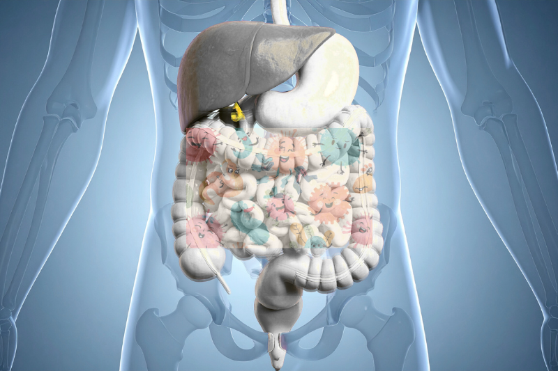 What is the Real Cause and Solution for Your Irritable Bowel Syndrome?