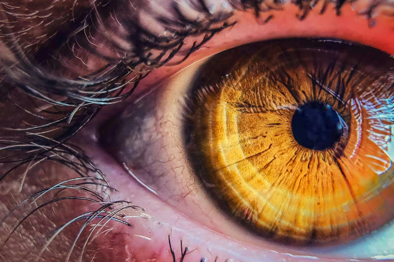 Nutritional Support for Macular Degeneration